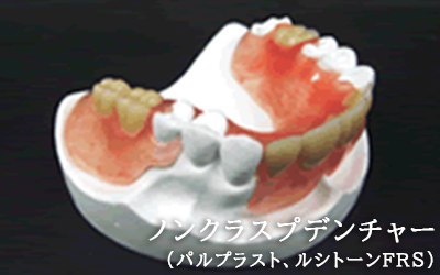 ノンクラスプデンチャー