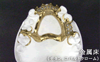 金属床